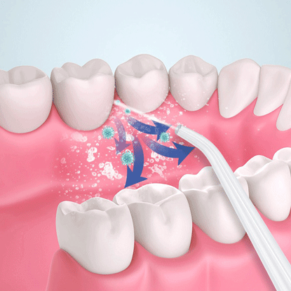 Image of Irrigador Bucal Inalámbrico Portátil