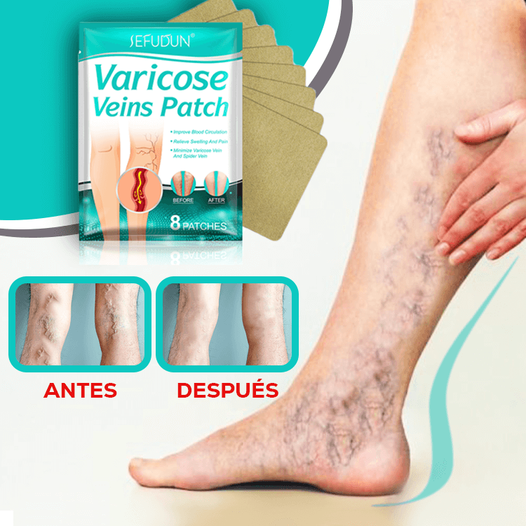 6 Parches para Varices Elimina las Venas Hinchadas